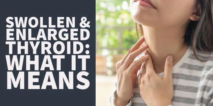 Why Is Your Thyroid Swollen? 5 Common Causes Explained